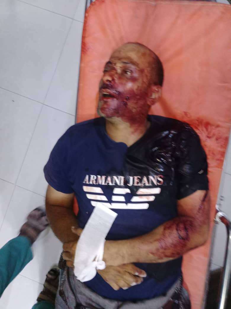 مقتل شخص إثر هجوم مسلح على محل صرافة بحضرموت 