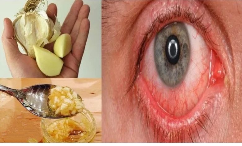 حبة واحدة فقط للقضاء على ضعف النظر نهائيا معجزة تحسين النظر في اقل من شهر.. شاهد