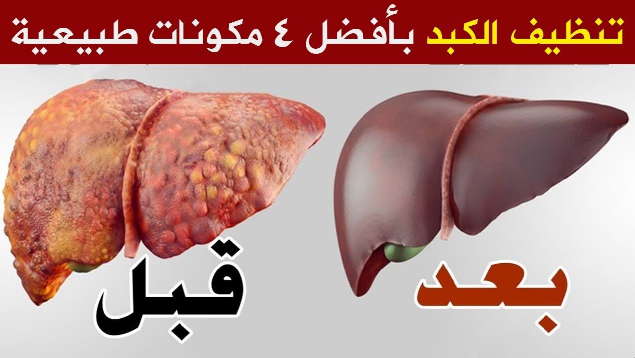 وداعاً لتراكم السموم في الجسم.. كوب واحد منه ينظف الكبد والجسم سيجعل كبدك جديدا 