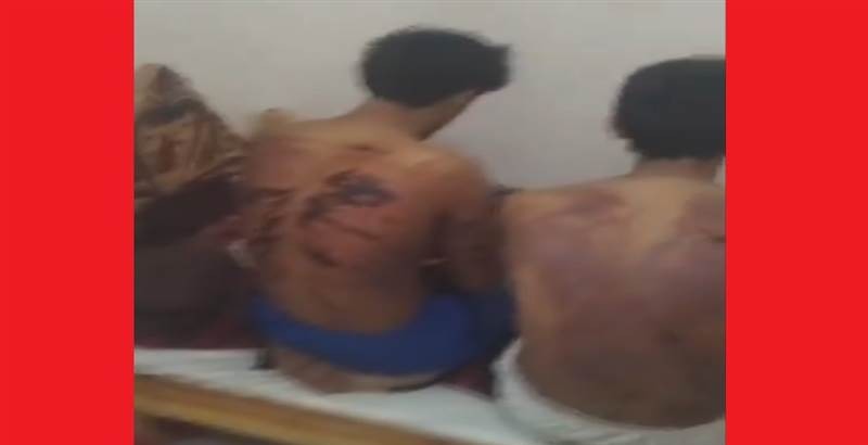 الجيش العُماني يرتكب أبشع جريمة تعذيب بحق سبعة شبان يمنيين.. شاهد بالصورة ماحدث..!