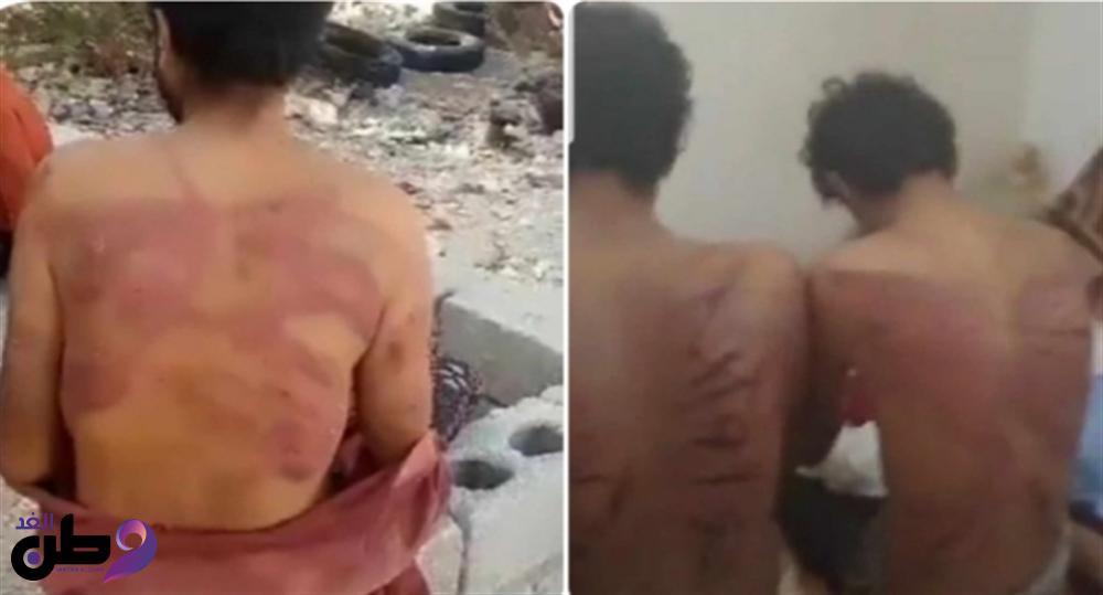 الحكومة تعلن تكليف فريق لمتابعة قضية شباب تعرضوا للتعذيب على يد الجيش العماني