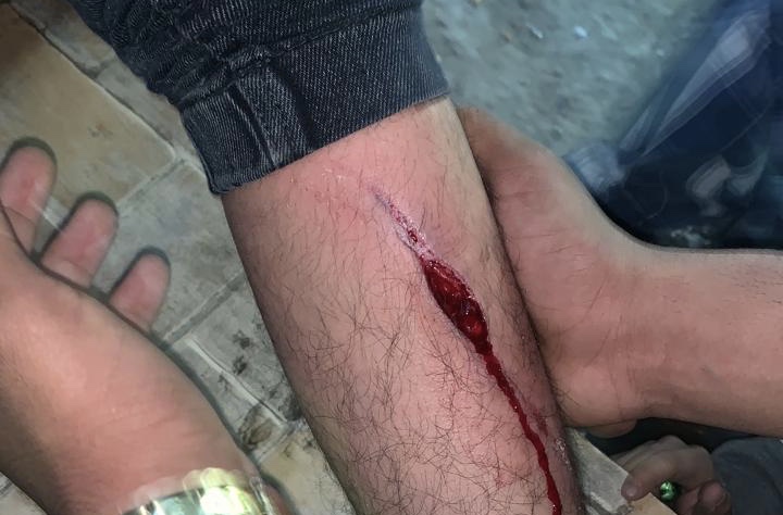 مصر : الاعتداء طعناً على طالب يمني بمنطقة العشرين بالقاهرة (شاهد الصورة)