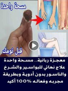 معجزة ربانية.. مسحة واحدة علاج نهائي للبواسير والشرخ والناسور بدون أدوية وبطريقه مجربه وفعاله 100%