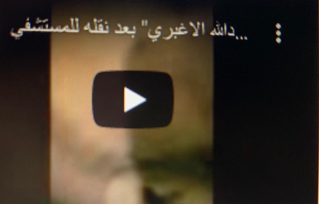 شاهد فيديو اللحظات الفارقة والأخيرة في حياة الشهيد " الأغبري " بعد وصوله للمستشفى بدقائق معدودة 
