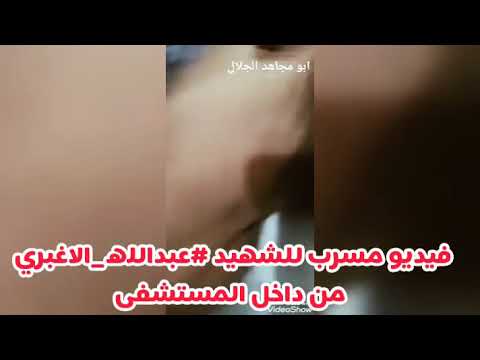 فيديو جديد يظهر فيه أصفرار مخيف لـ جسد الضحية الأغبري وضربات عميقة لـخنجر  الجنبية في ظهره وهو على نعش الموت في المستشفى