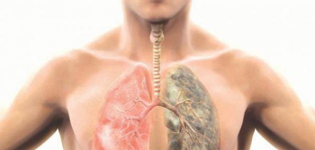 لماذا يصاب بعض المدخنين بسرطان الرئة والبعض الآخر لا يصاب .. دراسة تفجر مفاجأة!!