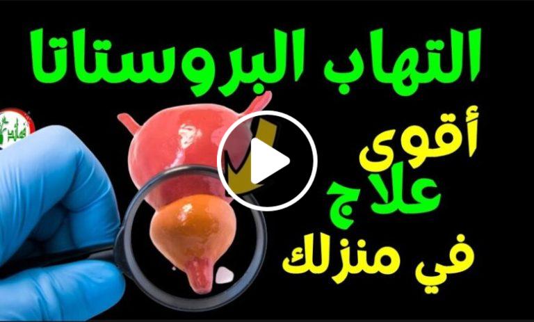 علاج التهاب البروستاتا في المنزل اقوى علاج لتضخم البروستاتا والتخلص من الحرقان وتقطر البول بالاعشاب