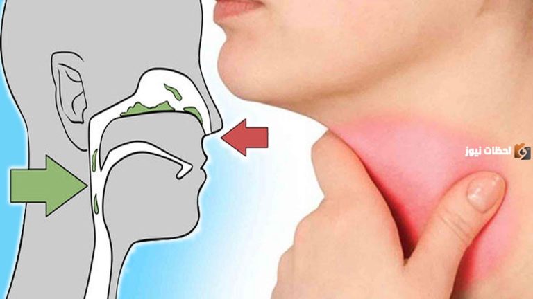 أقوى غرغره للتخلص من التهابات الحلق واللوزتين والحنجرة ورائحة الفم الكريهة ومذيب للبلغم و مبيض للأسنان