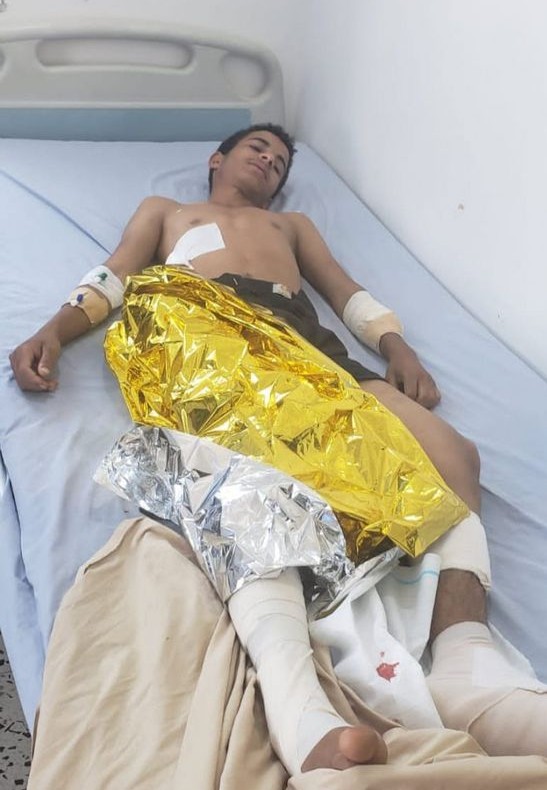 انفجار مقذوف من مخلفات مليشيا الحوثي في 3 أطفال شمال الضالع