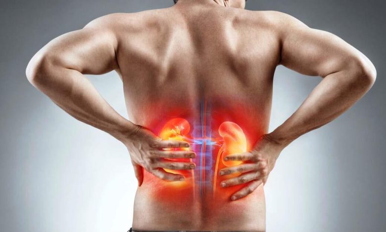  تدمر الكلى … مادة موجودة في جميع البيوت وتستخدم فيها الأطعمة تعرف عليها واحذر منها