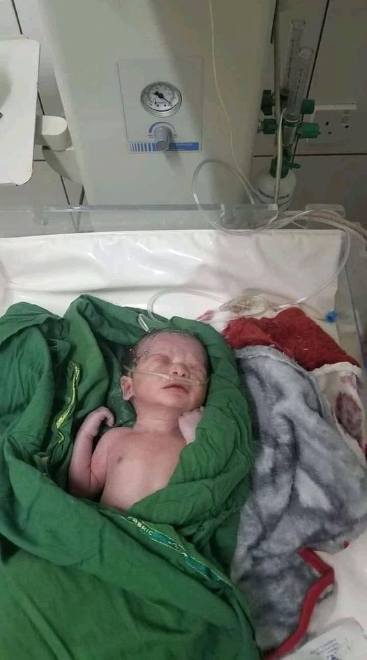 جريمة للحوثيين تطال جنين يمني ما يزال في بطن امه وحالة طوارئ في مستشفى الثورة لإنقاذ الطفل