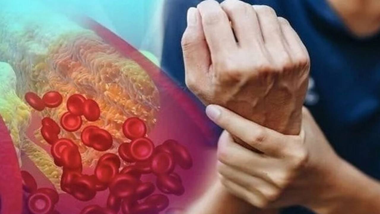 ارتفاع الكوليسترول الضار بالدم