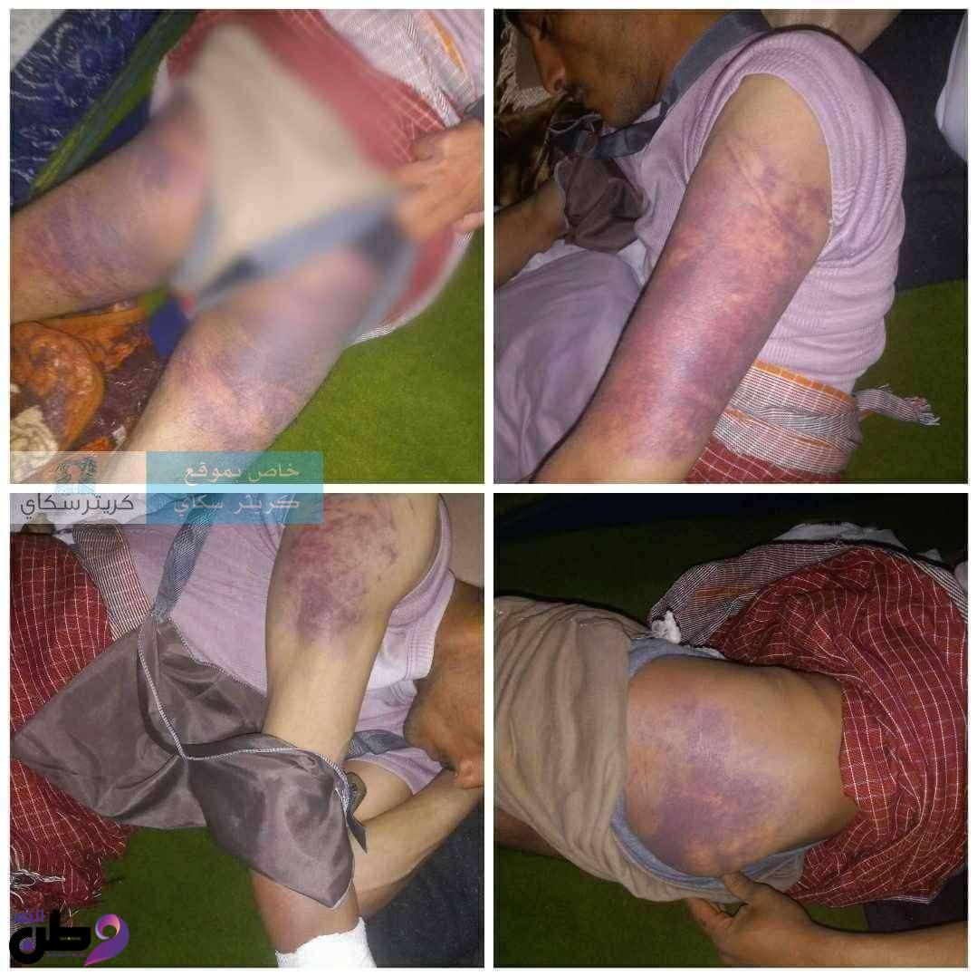 جريمة بشعة تهز الضمير الإنساني.. قيادي حوثي يعتدي بوحشية على شاب شمالي صنعاء 